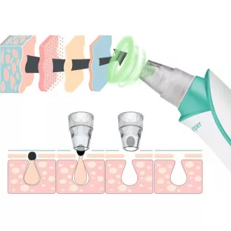 P302VIS001 CURĂȚĂTOR DE PORI FACIAL BEPER P302VIS001 CURĂȚĂTOR DE PORI FACIAL BEPER