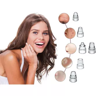 P302VIS001 CURĂȚĂTOR DE PORI FACIAL BEPER P302VIS001 CURĂȚĂTOR DE PORI FACIAL BEPER